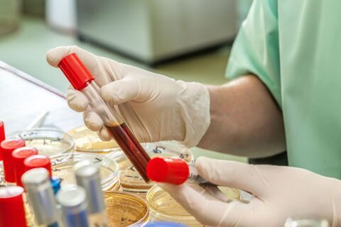 A novel real-time PCR assay